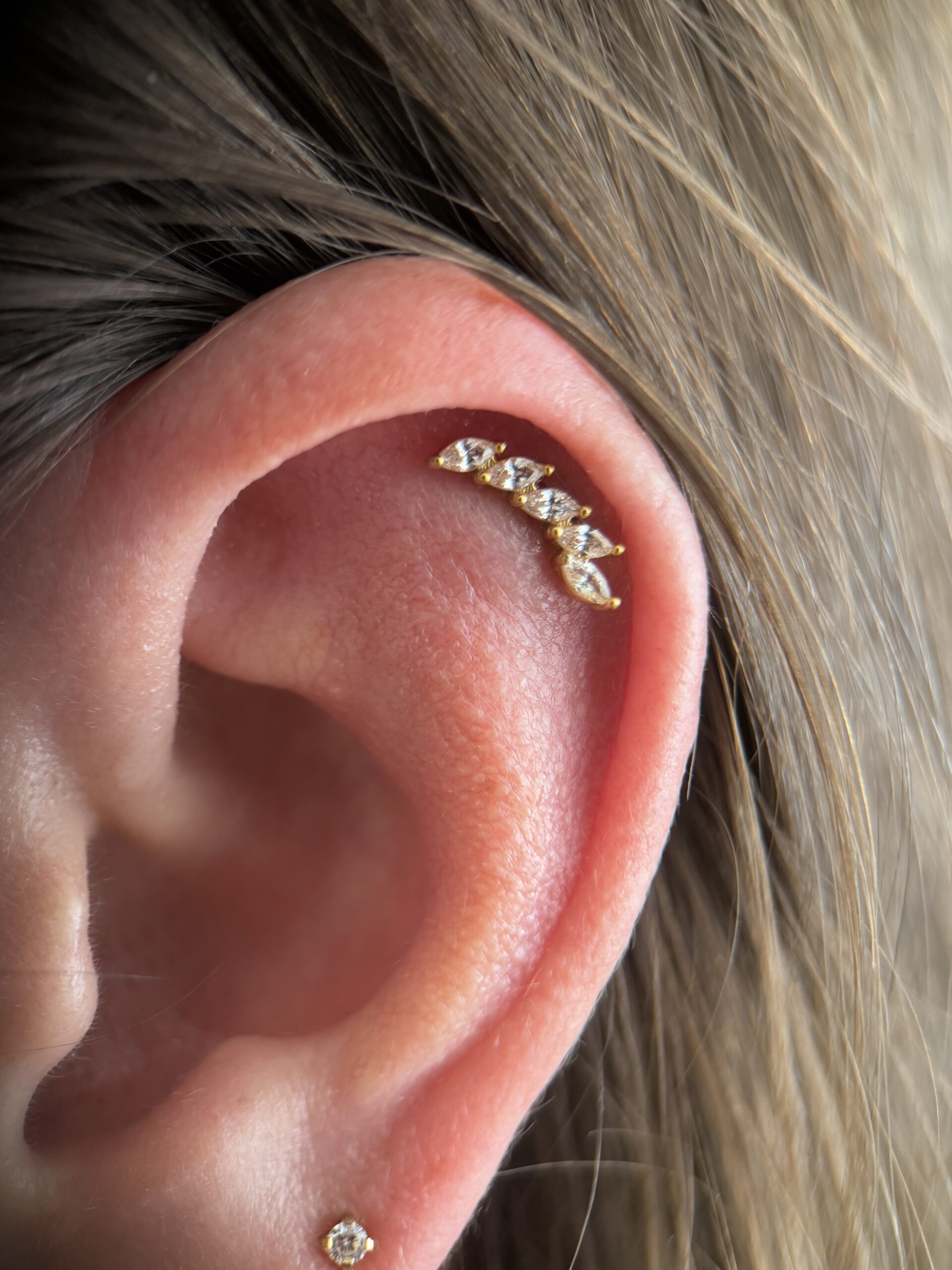 helix